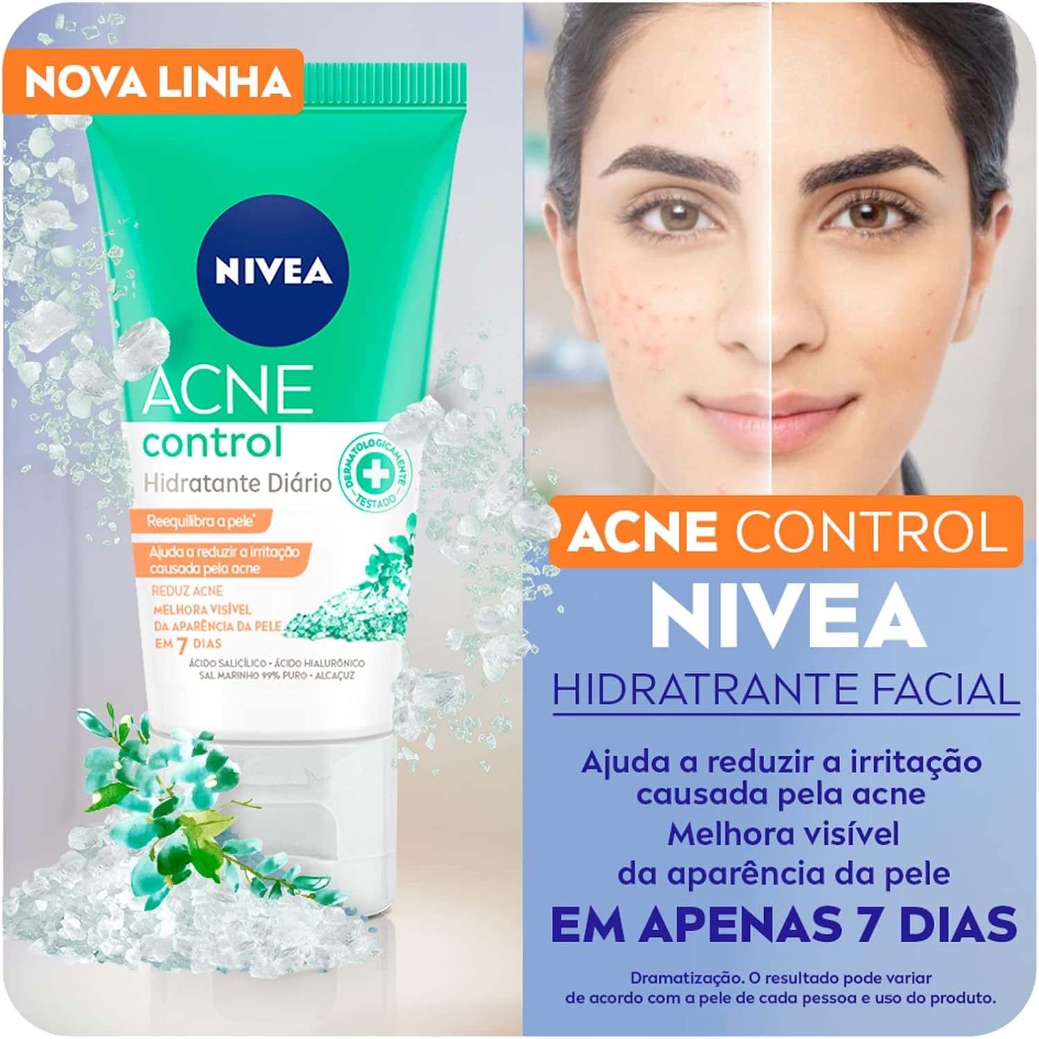 NIVEA Hidratante Facial Acne Control – 50g na Amazon